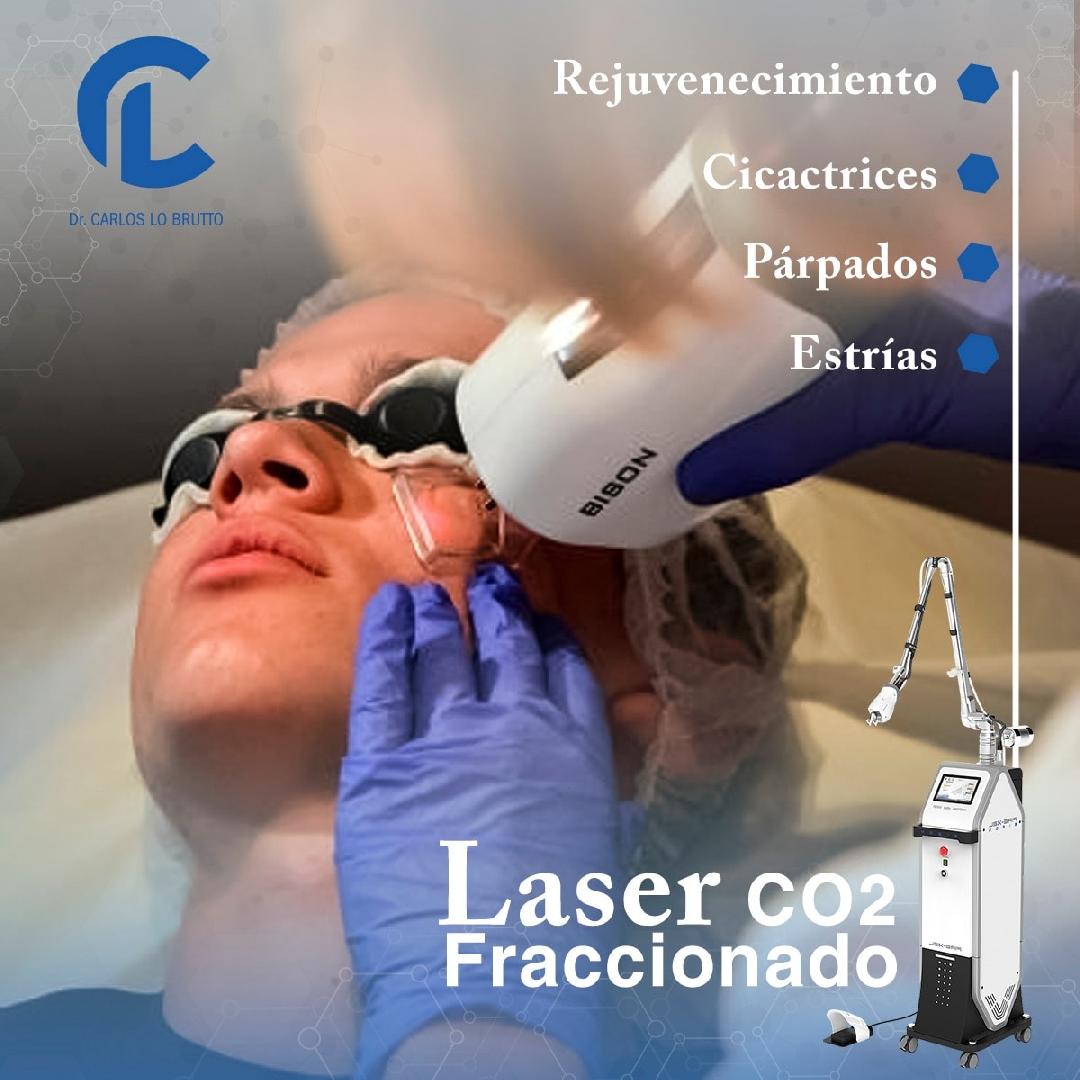 Láser CO2 fraccionado